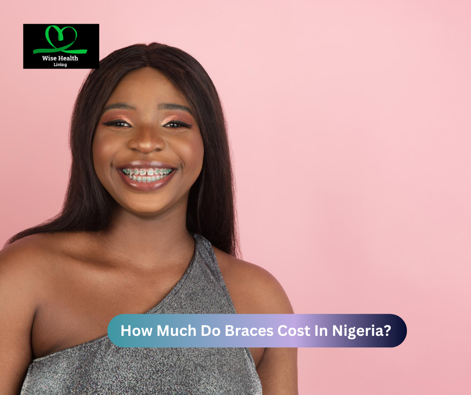 How Much Do Braces Cost In Nigeria?